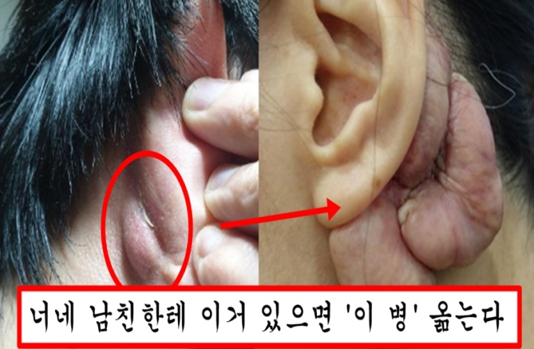 남자들 대부분 귀 뒷 부분 안씻는데 여자들이 요즘 남자 소개 받으면 귀 뒤부터 확인하는 이유